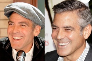 Detail George Clooney Veneers Nomer 5