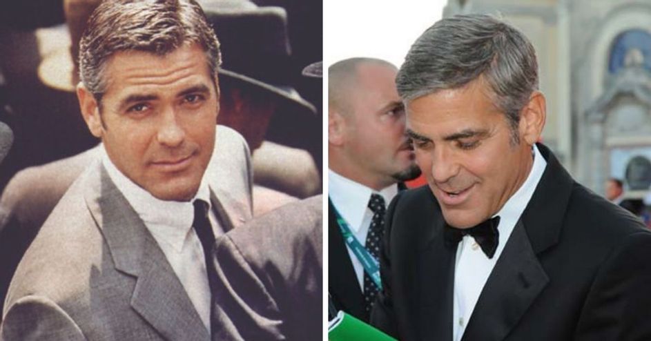 Detail George Clooney Veneers Nomer 51