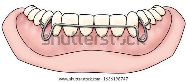 Detail Gigi Palsu Vector Nomer 22