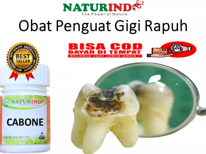 Detail Gigi Rapuh Nomer 33
