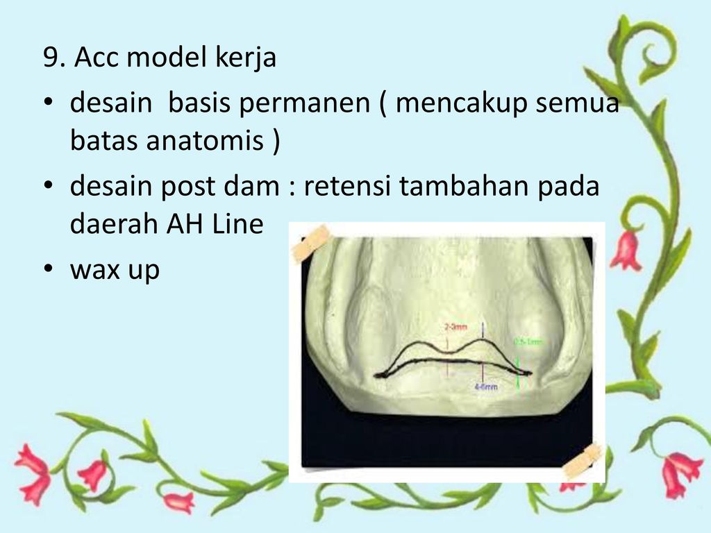 Detail Desain Gigi Tiruan Lengkap Nomer 5