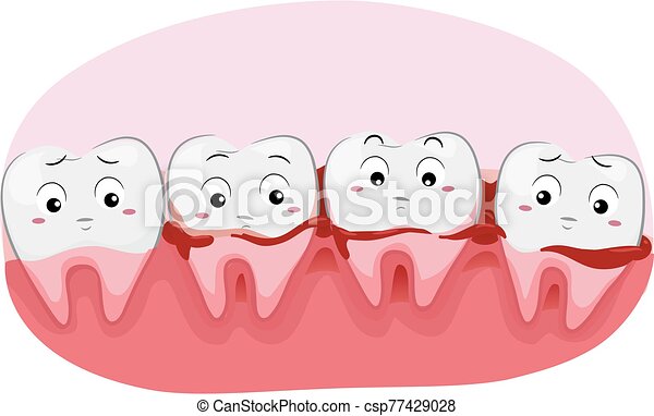 Detail Gums Clipart Nomer 12