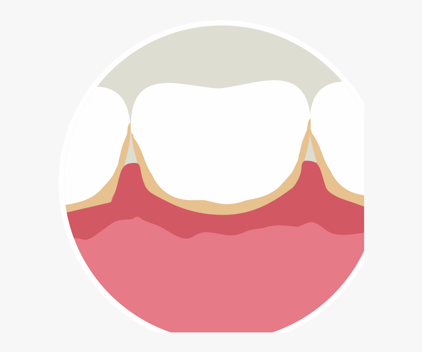 Detail Gums Clipart Nomer 19