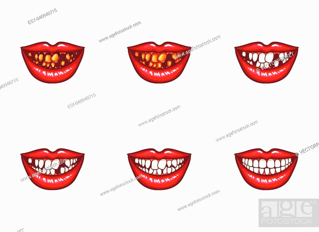 Detail Gums Clipart Nomer 28