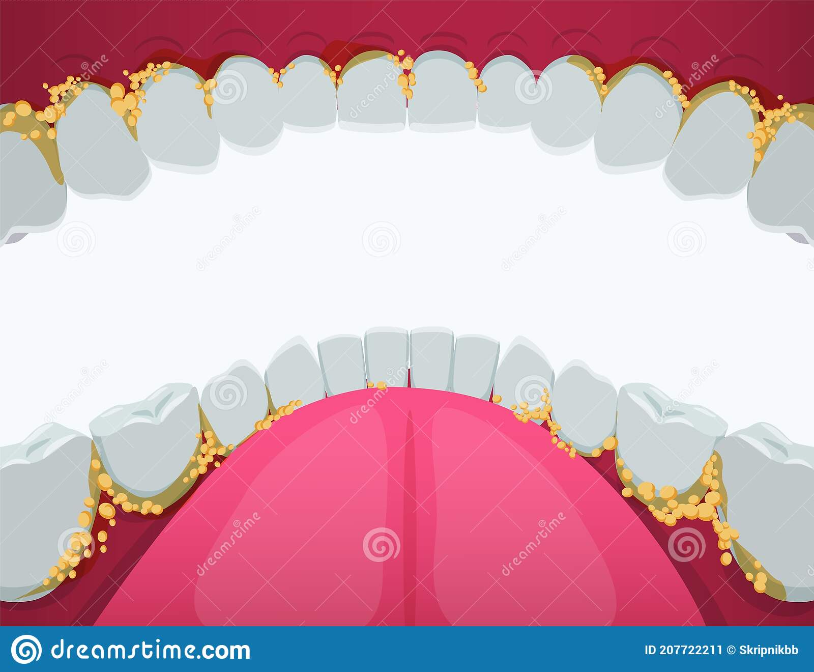 Detail Gums Clipart Nomer 34