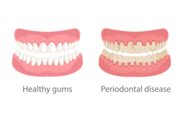 Detail Gums Clipart Nomer 45