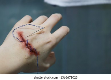 Detail Hand Cut Blood Images Nomer 14
