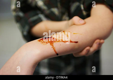 Detail Hand Cut Blood Images Nomer 33
