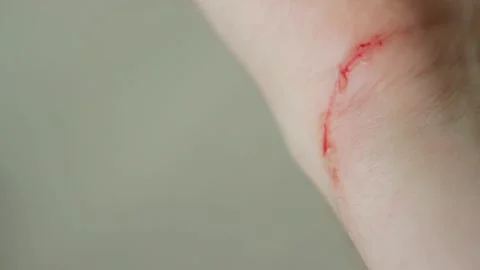 Detail Hand Cut Blood Images Nomer 36