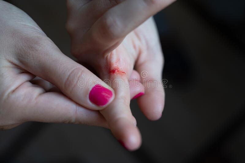 Detail Hand Cut Blood Images Nomer 40