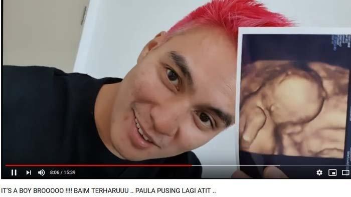 Detail Hasil Gambar Usg Bayi Laki Laki Nomer 31