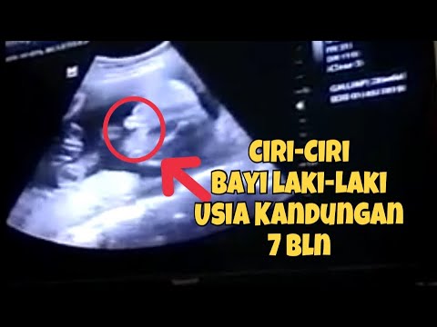 Detail Hasil Gambar Usg Bayi Perempuan Nomer 19