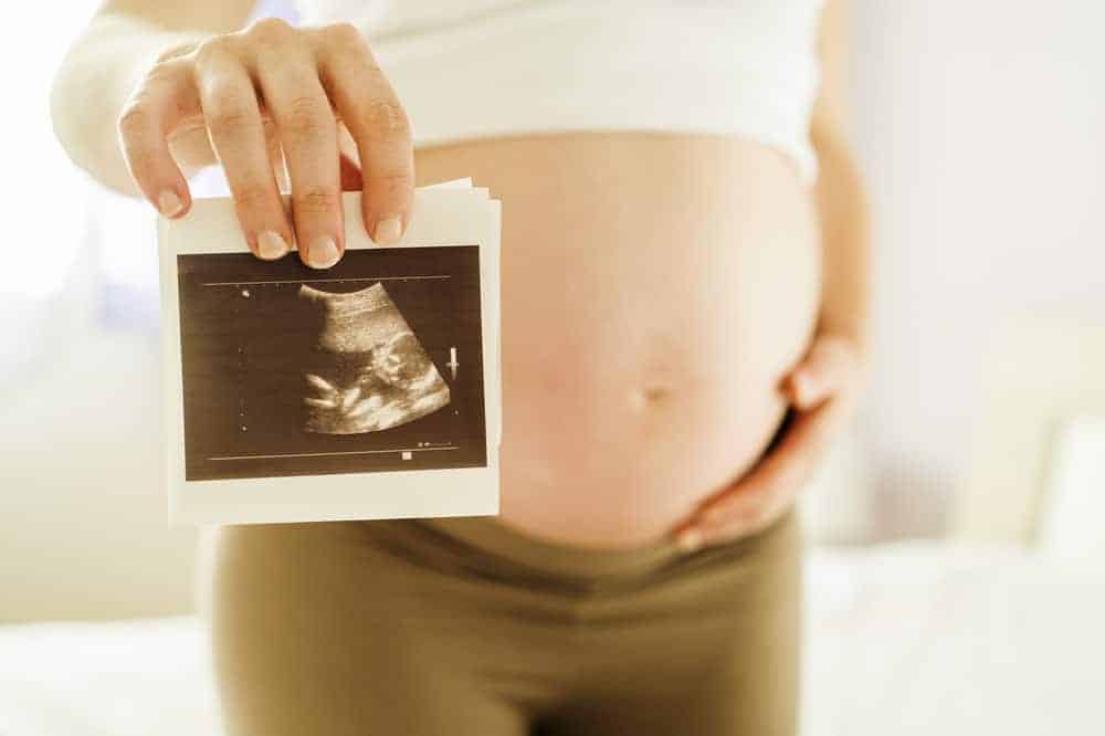 Detail Hasil Gambar Usg Bayi Perempuan Nomer 40