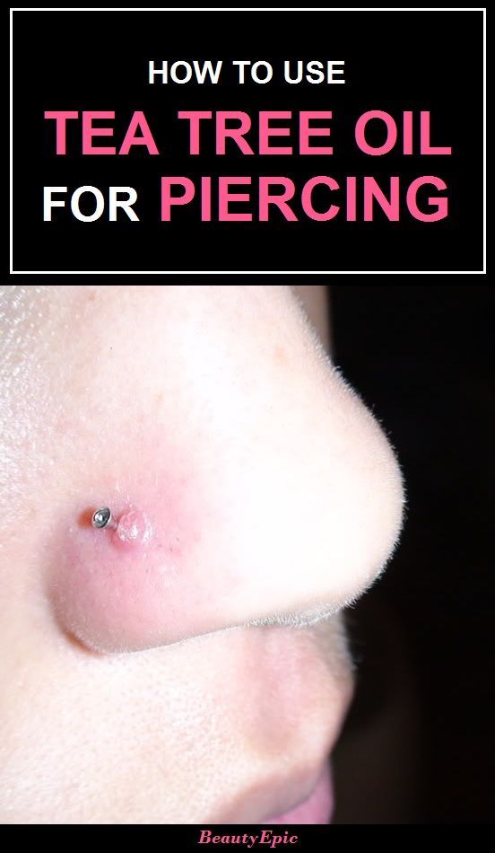 Detail How To Apply Tea Tree Oil To Nose Piercing Nomer 2