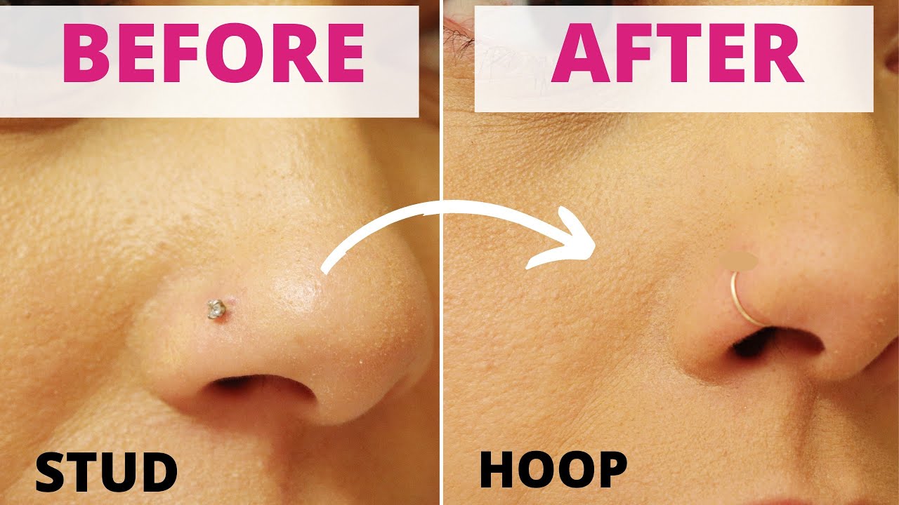 Detail How To Apply Tea Tree Oil To Nose Piercing Nomer 53