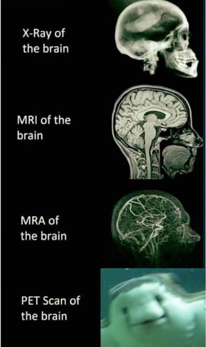Detail Human Brain Meme Nomer 14