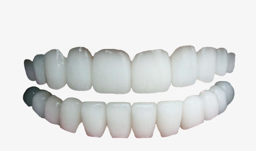 Detail Human Teeth Png Nomer 2