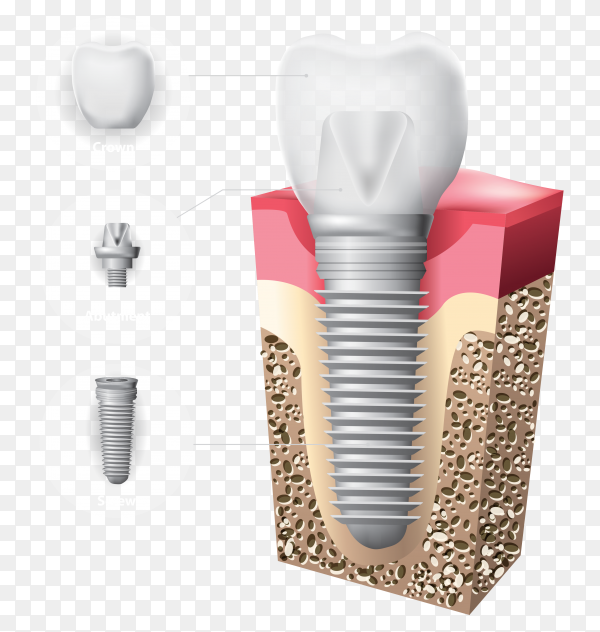 Detail Human Teeth Png Nomer 48