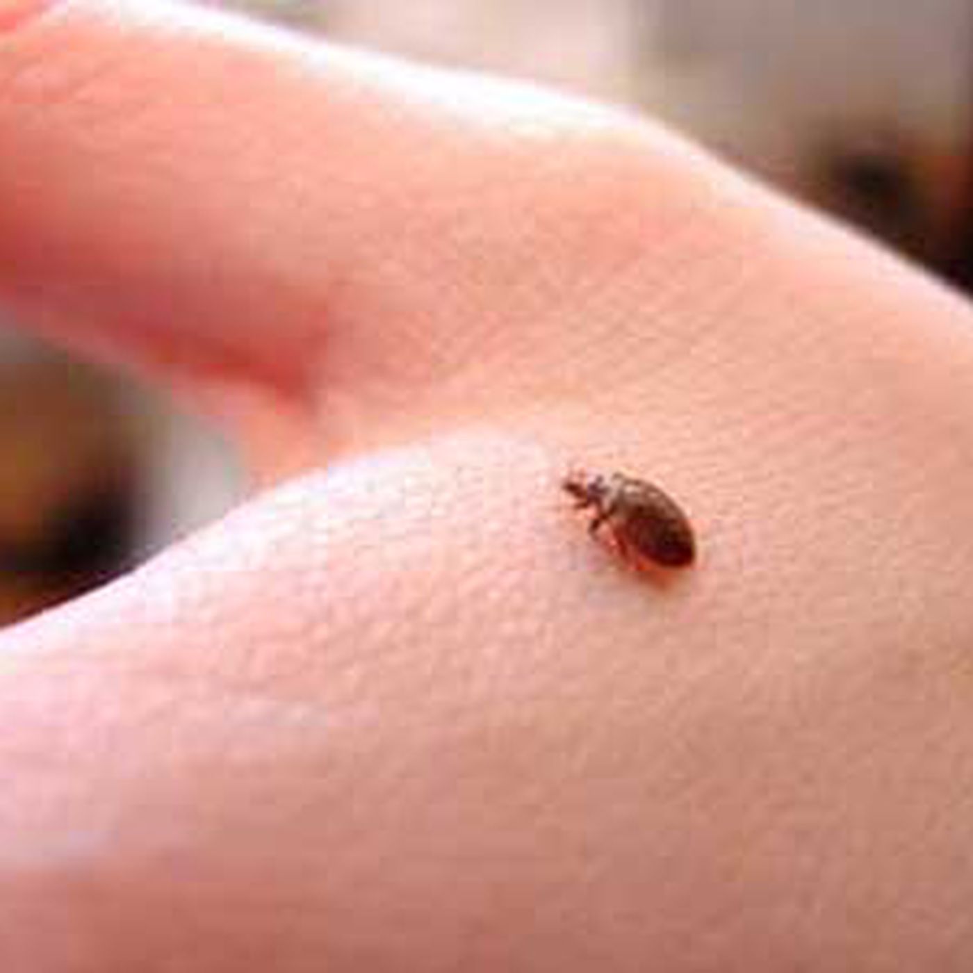 Detail Image Of A Bedbug Nomer 13