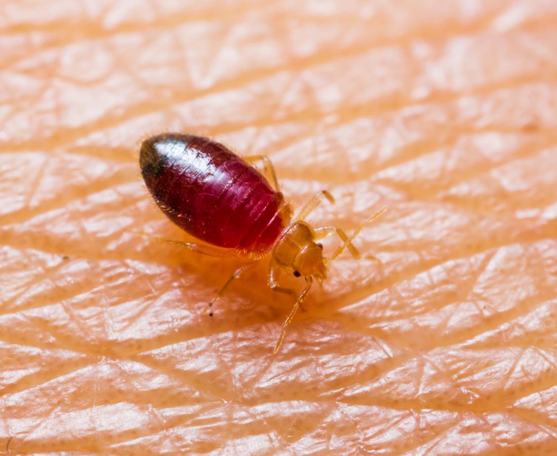 Detail Image Of A Bedbug Nomer 22