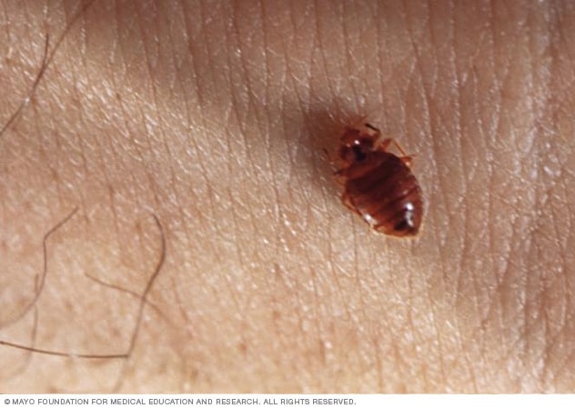 Detail Image Of A Bedbug Nomer 44