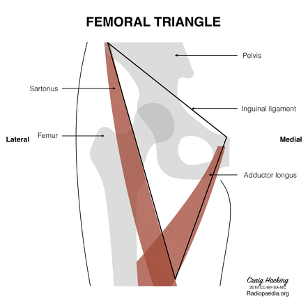 Detail Image Of A Triangle Nomer 43