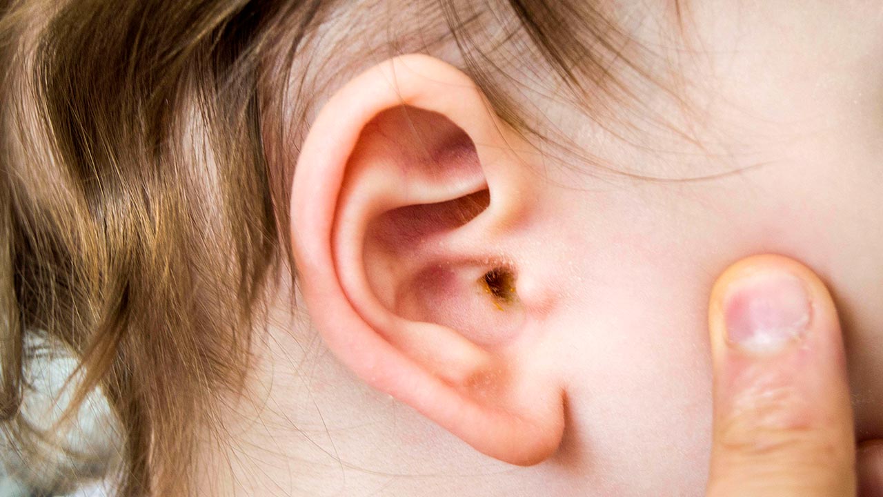 Detail Image Of An Ear Nomer 21