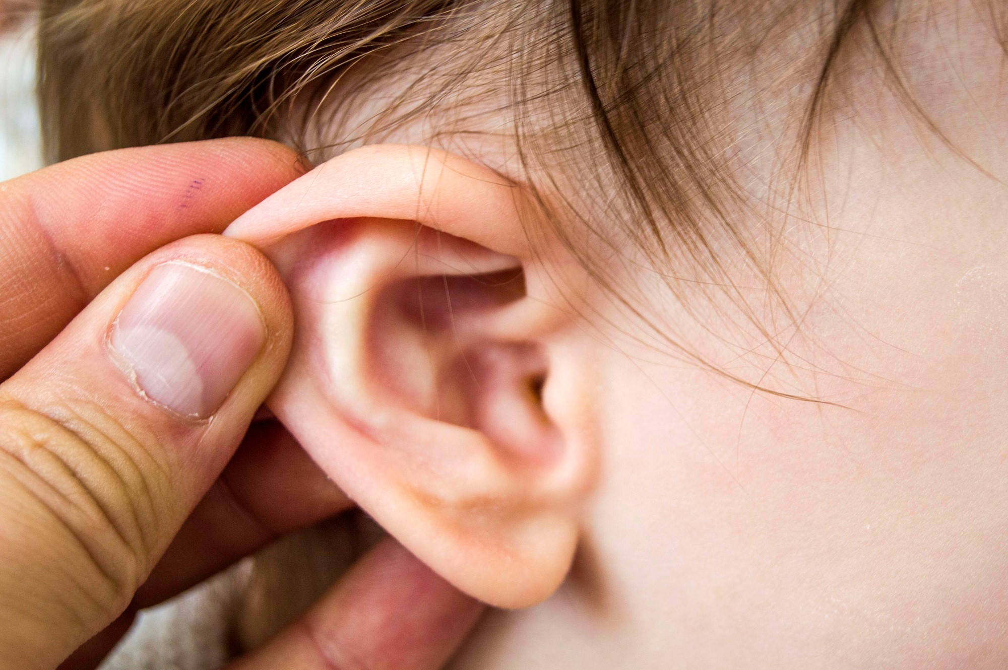Detail Image Of An Ear Nomer 26