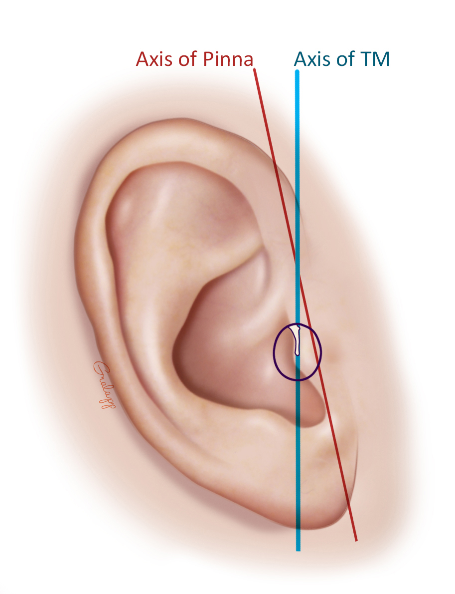 Detail Image Of An Ear Nomer 27