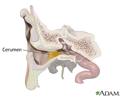 Detail Image Of An Ear Nomer 35