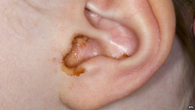 Detail Image Of An Ear Nomer 45