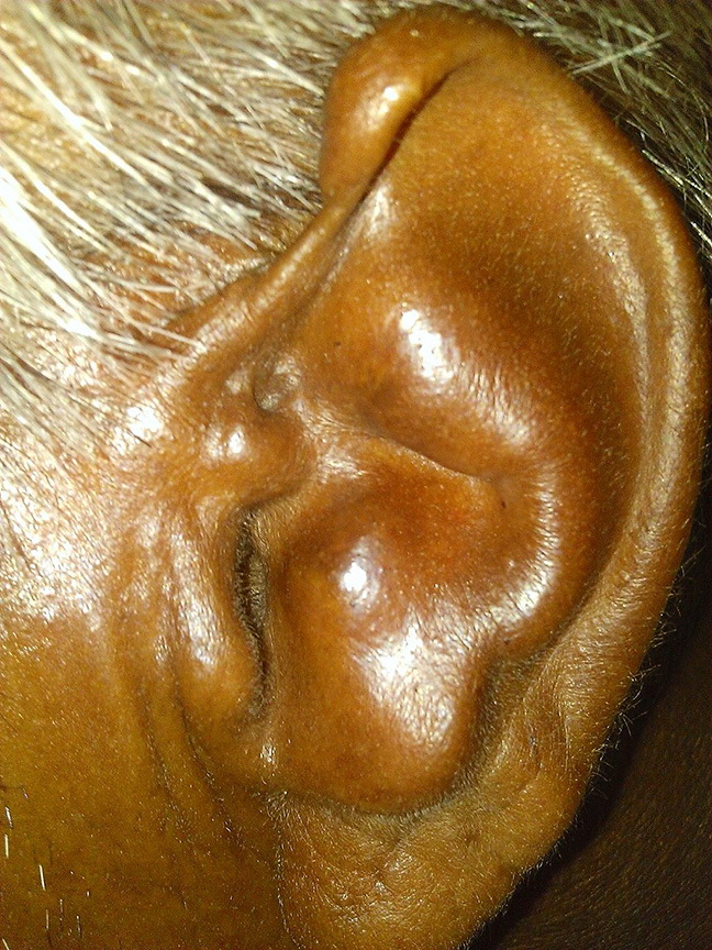 Detail Image Of An Ear Nomer 46