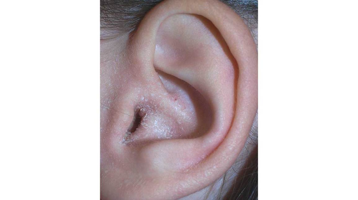 Detail Image Of An Ear Nomer 48
