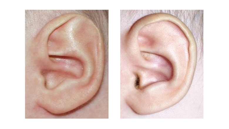 Detail Image Of An Ear Nomer 49