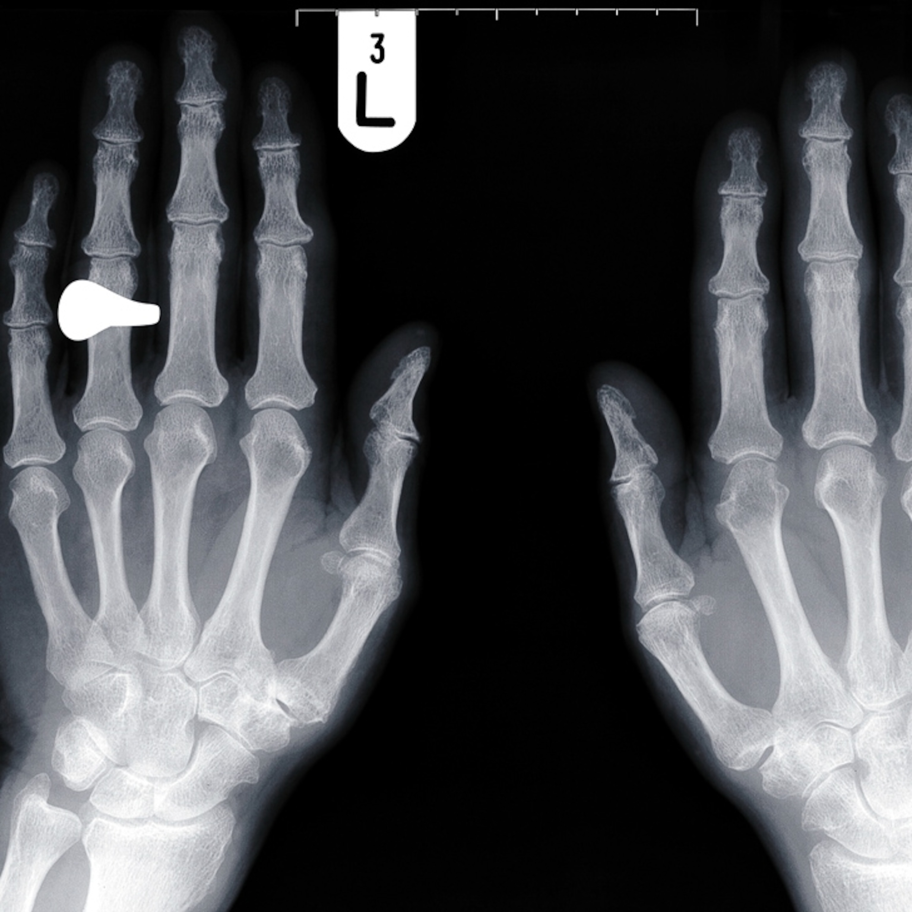 Detail Image Of Fingers Nomer 53