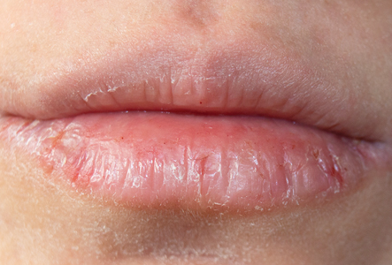 Detail Image Of Lips Nomer 48
