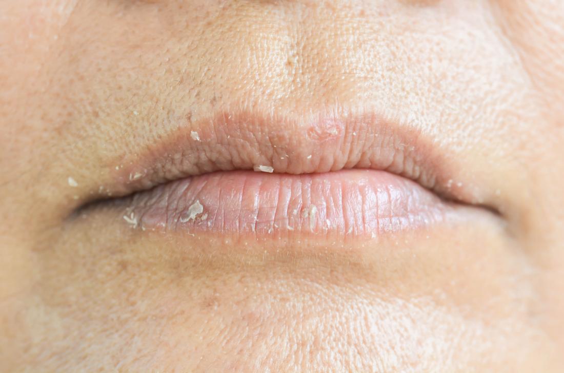 Detail Image Of Lips Nomer 57