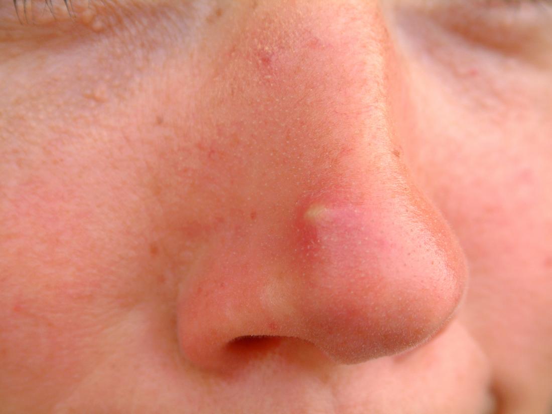 Detail Image Of Nose Nomer 25