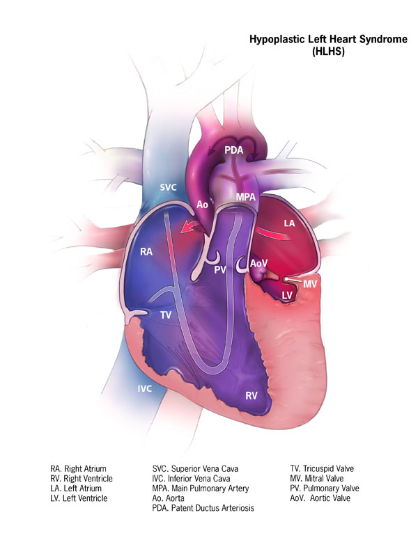 Detail Image Of The Heart Nomer 39