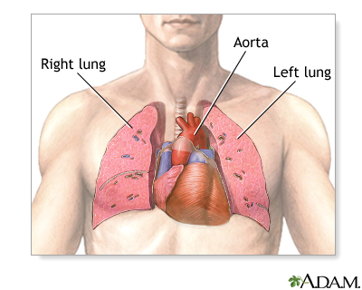 Detail Image Of The Heart Nomer 44