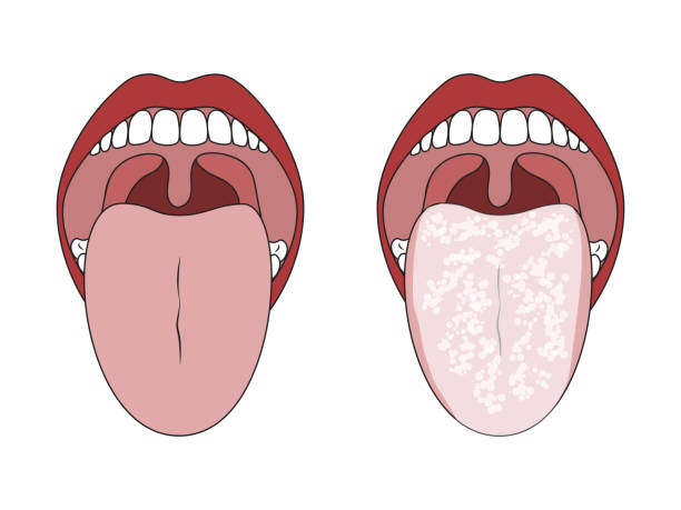 Detail Images Of A Tongue Nomer 24