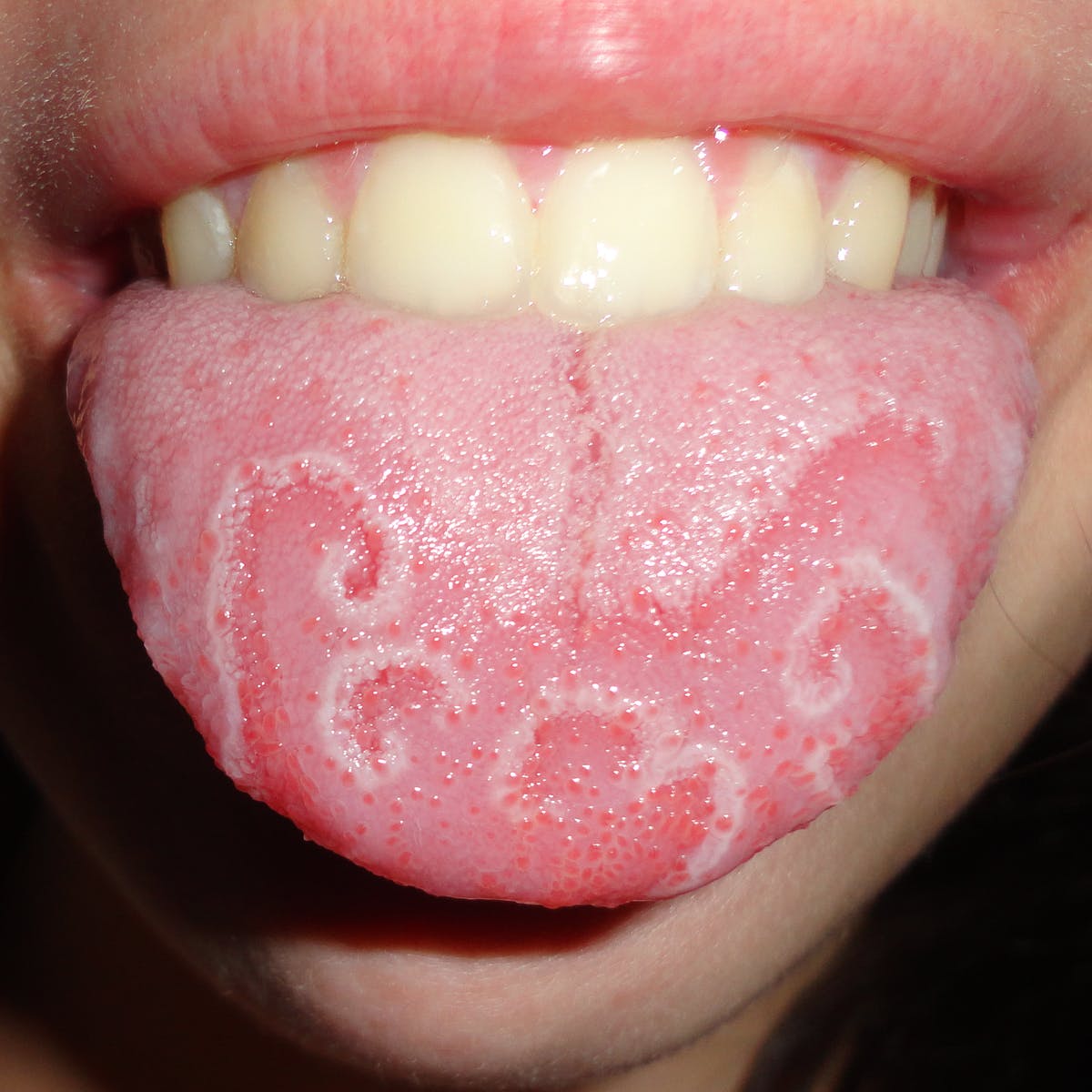 Detail Images Of A Tongue Nomer 27