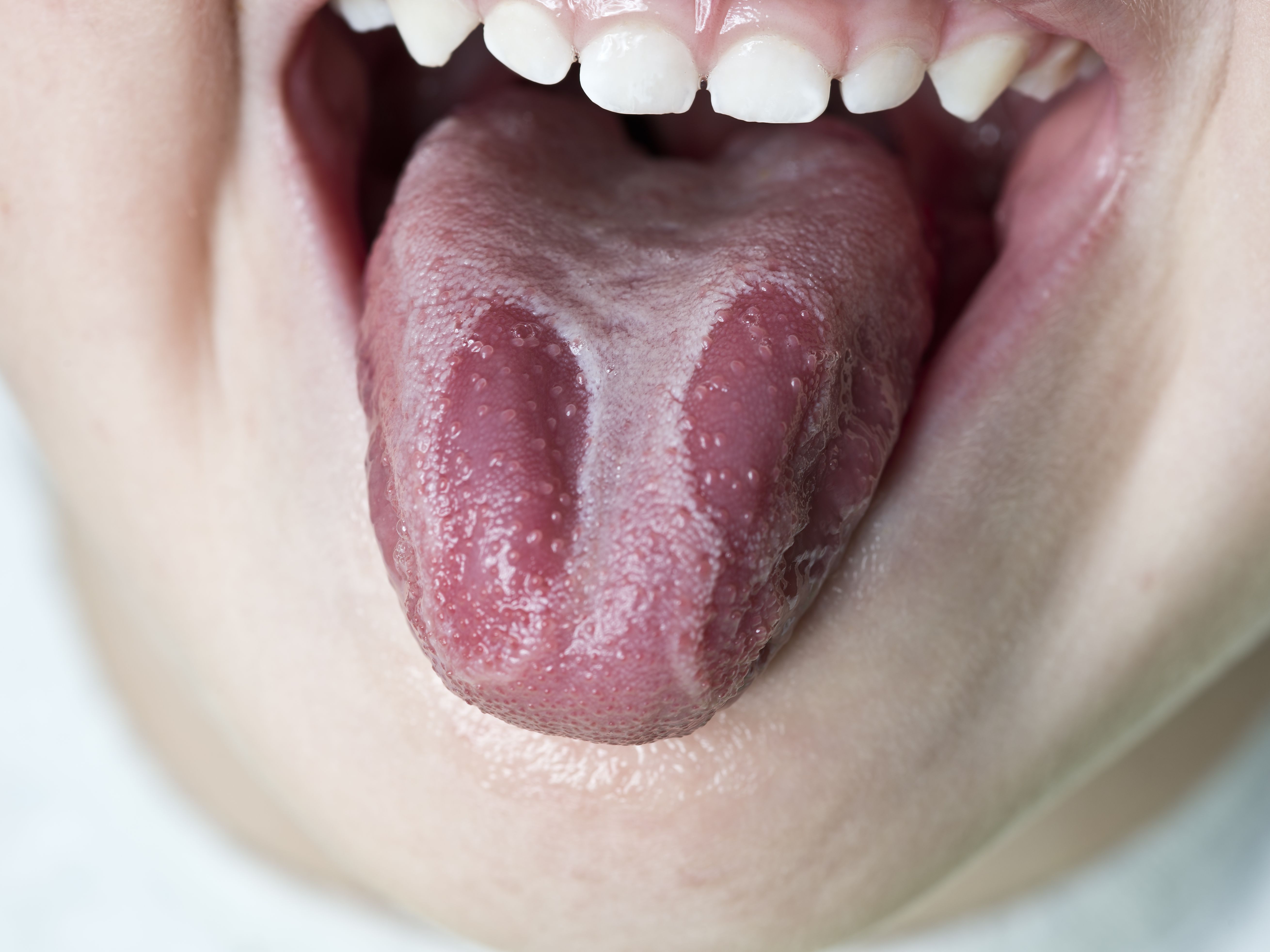 Detail Images Of A Tongue Nomer 28