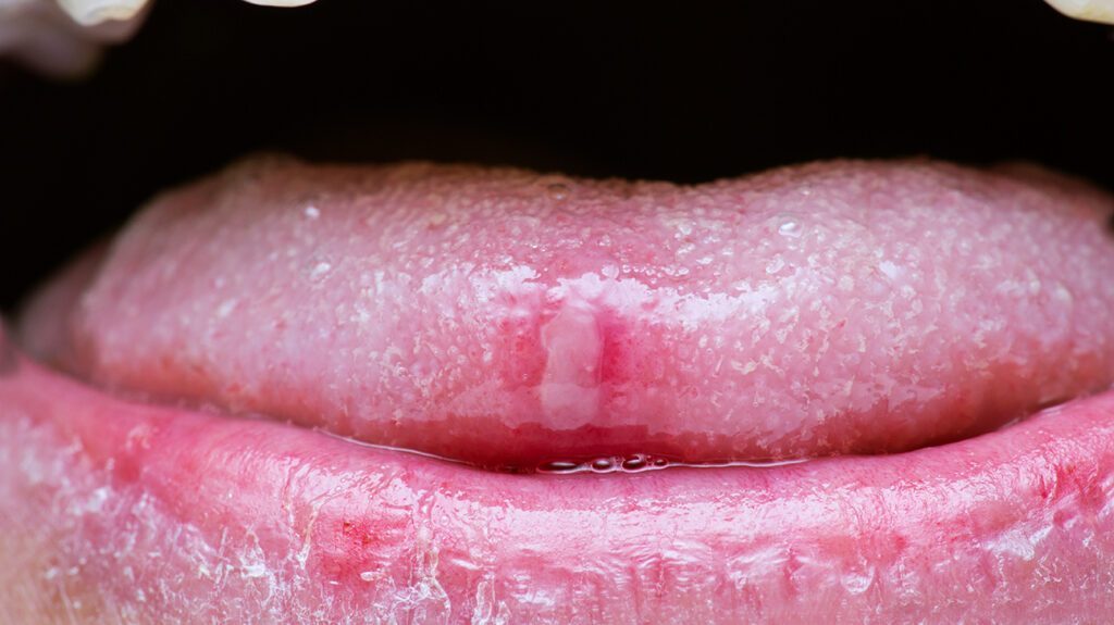 Detail Images Of A Tongue Nomer 39