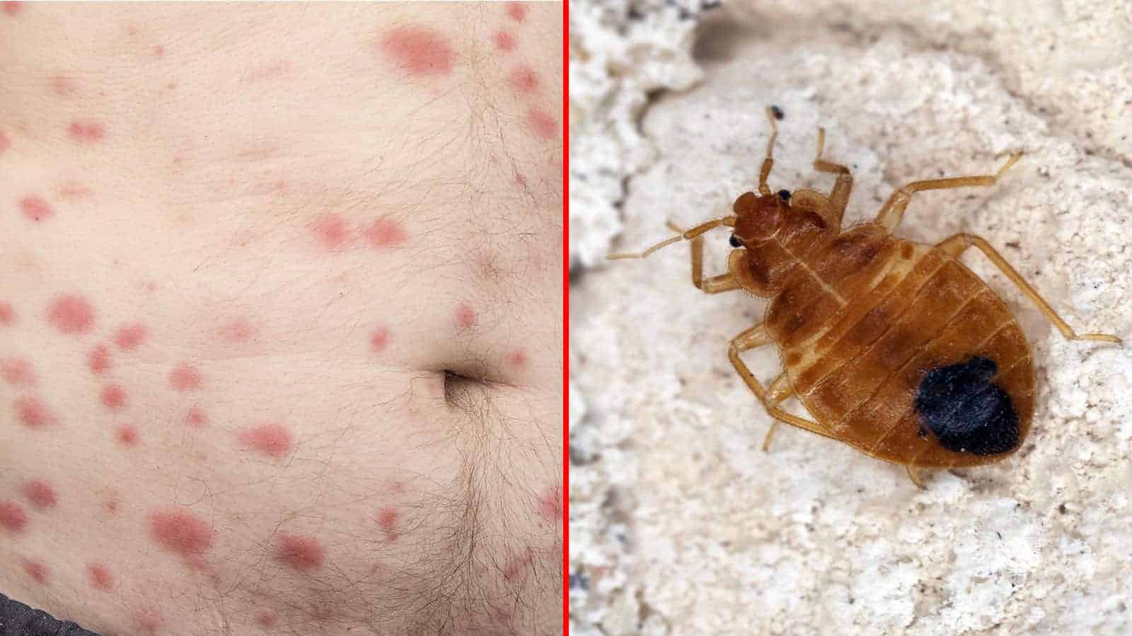 Detail Images Of Bed Bugs On A Bed Nomer 39