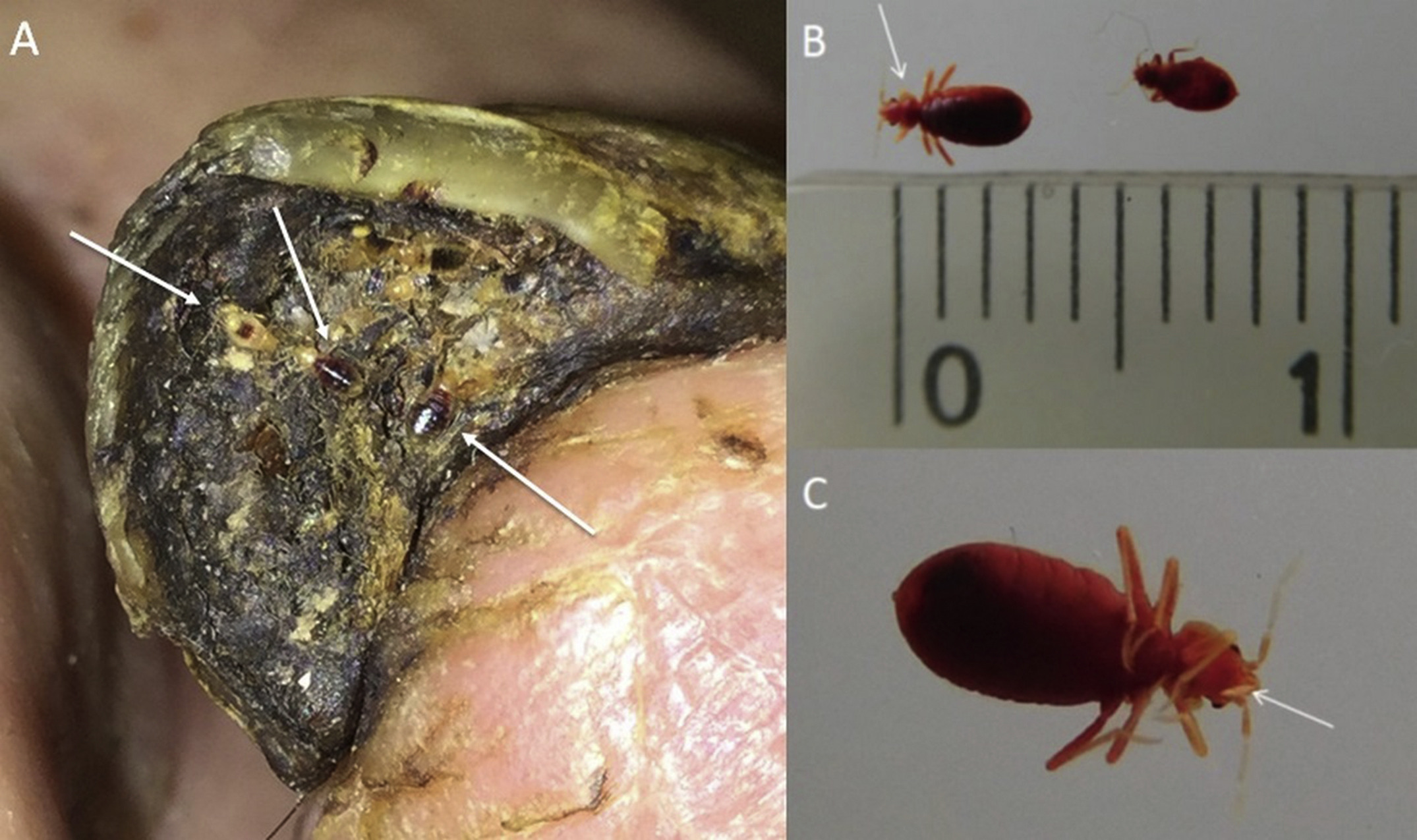 Detail Images Of Bedbugs Nomer 29