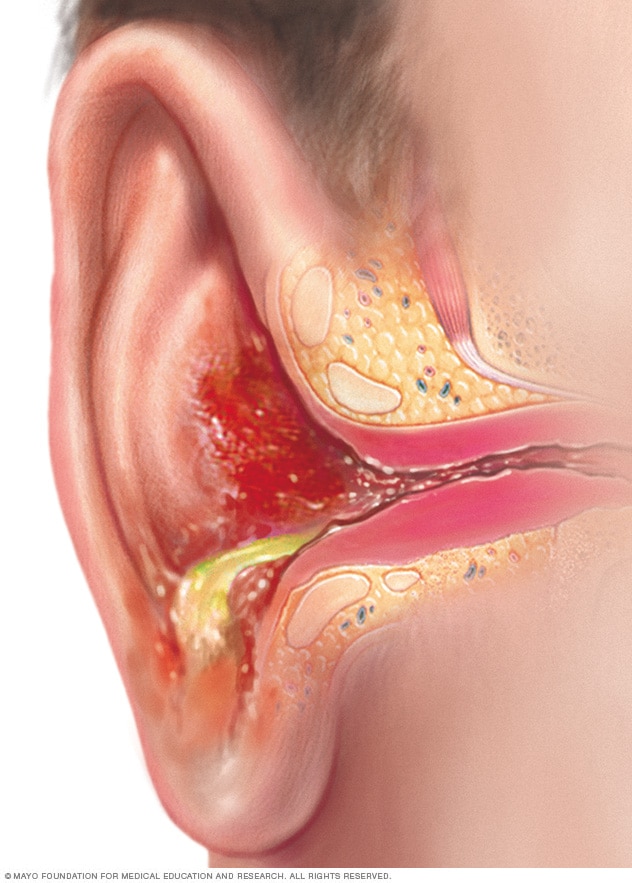 Detail Images Of Ear Nomer 29