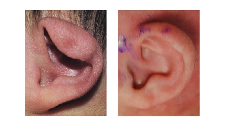 Detail Images Of Ear Nomer 51