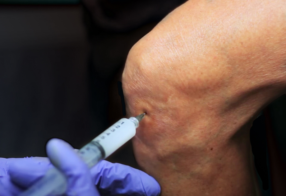 Detail Images Of Injection Needles Nomer 16
