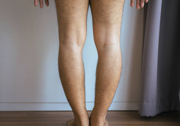 Detail Images Of Legs Nomer 43